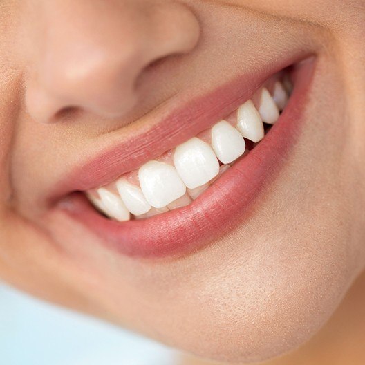 Woman sharing healthy smile after fluoride treatment