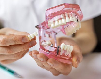 a dentist holding a model of dental implants